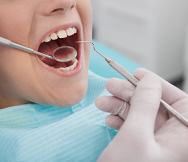 DENTAL CONSUMABLES