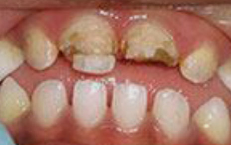 Children Dentist