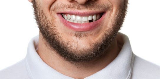 Missing Tooth