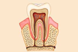 root canal treatment RCT near me