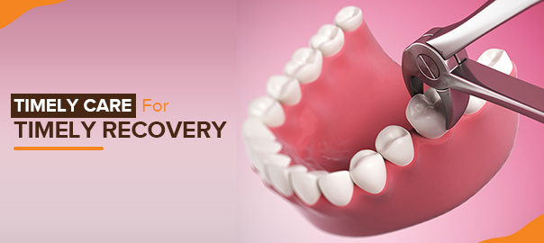 Tooth Extraction