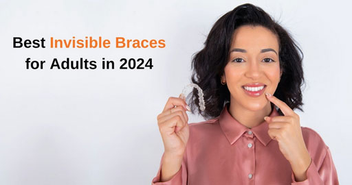 Best Invisible Braces for Adults in 2024