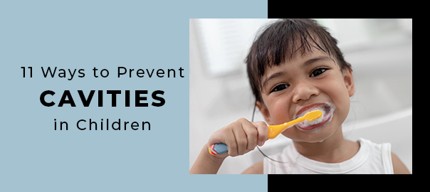 Cavity Prevention Tips