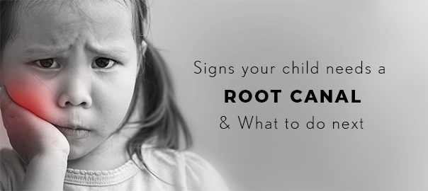 root canals in children